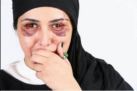 صورت زخمی باران کوثری پس از تصادف, باران کوثری, عکس باران کوثری, تصادف باران کوثری در فیلم هفت ماهگی