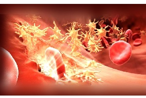 بیماری هموفیلی چه تاثیری بر زندگی فرد مبتلا می گذارد؟