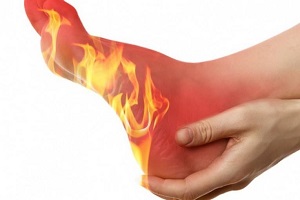 علت داغی کف پا در شب ها