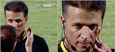 برخورد سنگ با صورت کمک داور بازی