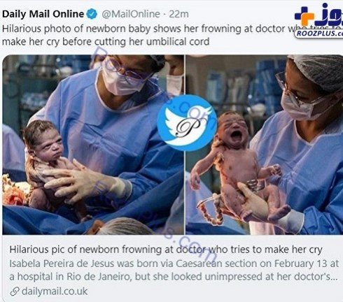 نگاه نوزاد به پزشک نگاه نوزاد به پزشک