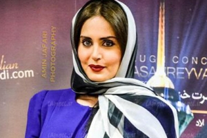 عکس الناز شاکردوست از چشم رنگی اش!