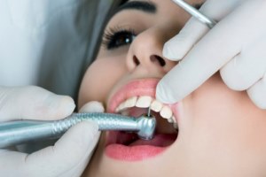 نباید بیشتر از 8 دندان پر شده داشته باشید