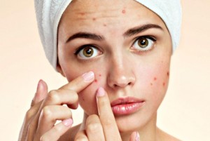 این غذاهای سالم موجب جوش صورت تان می شود!!