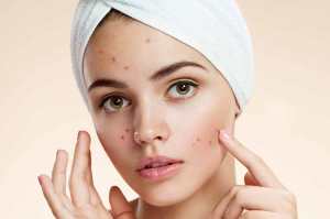 با جوش های قرمز بعد از وکس چه کنیم؟