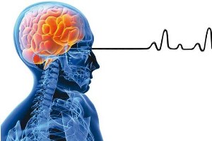 نشانه​های ضربه مغزی
