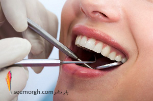 التهاب لثه در کمین این افراد است
